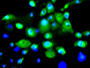 Infectious Disease