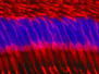 Retinal Degenerations