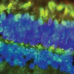 Ocular Regenerative Medicine