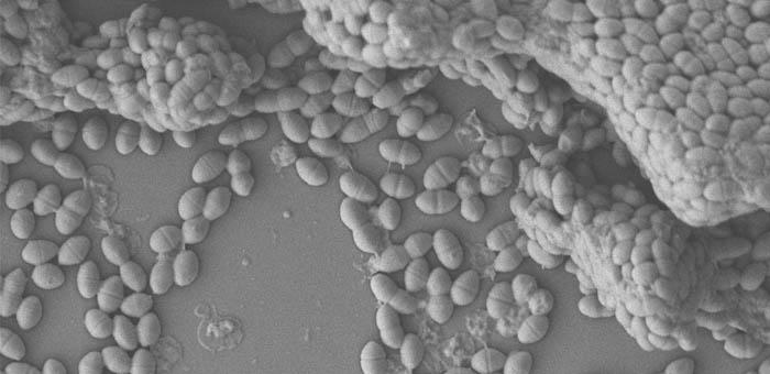 enterococcus