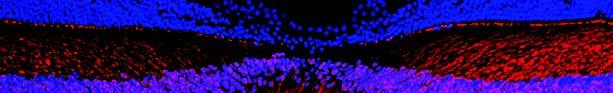 Genetic testing for eye disease
