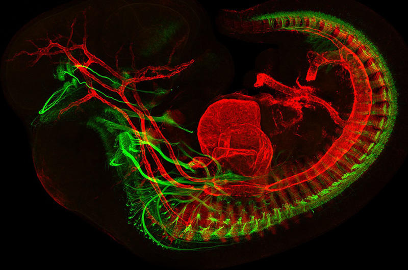 Winning Brain Image